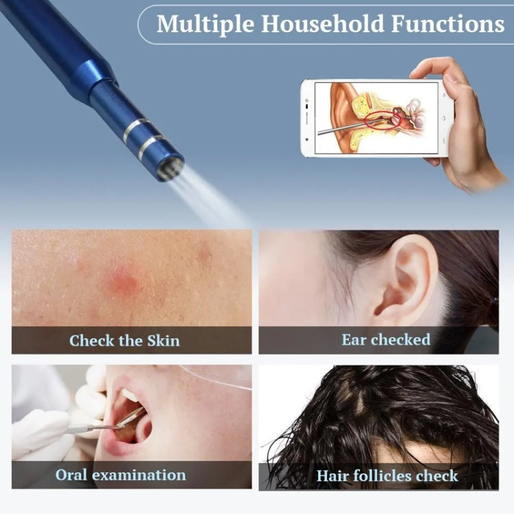 i95 3 in 1 USB Ear Scope Inspection HD 0.3MP Camera Visual Ear Spoon for OTG Android Phones & PC & MacBook, 1.75m Length Cable, 3 in 1 White  0.3MP