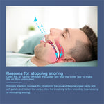 YJK100 Silicone + ABS Stop Snoring Device Anti Snore