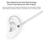 Supereyes Y001 Ear Mite Mouth Electronic Digital Fixed Focus Endoscope, Y001