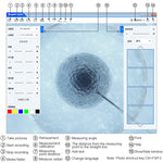 Supereyes Y008 Ear Nose Mouth Wireless Digital Electronic Endoscope, Y008