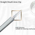 5pcs /Set Acne Needle Stainless Steel Acne Clamp Squeeze Acne Blackhead Tool, 2 in 1, 5 in 1
