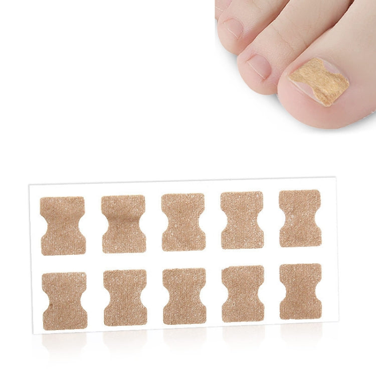 10 PCS Glue-free Orthopedic Nail Stick Toe Nail Groove Inlay Corrector, Transparent Bottom, White Bottom, Blue Bottom