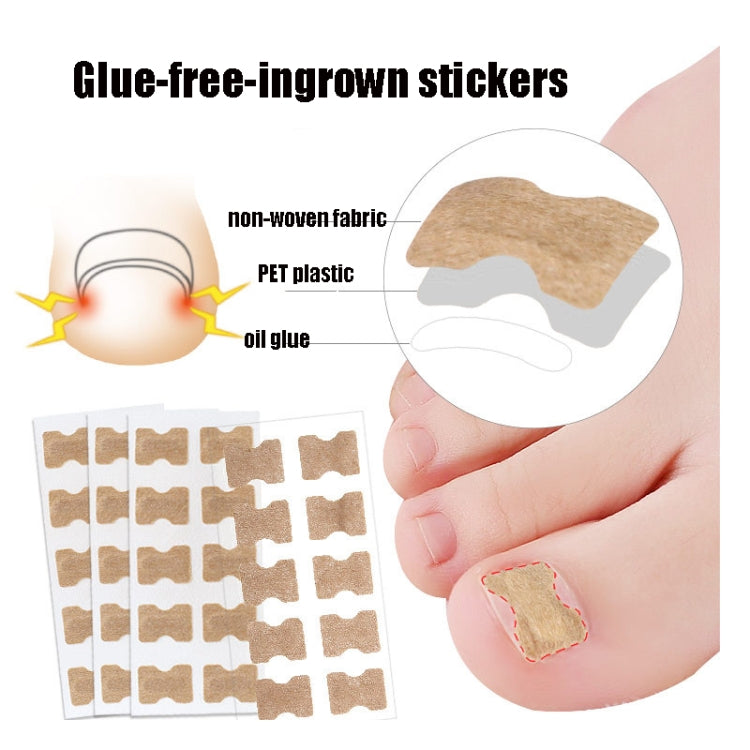 10 PCS Glue-free Orthopedic Nail Stick Toe Nail Groove Inlay Corrector, Transparent Bottom, White Bottom, Blue Bottom