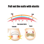 10 PCS Glue-free Orthopedic Nail Stick Toe Nail Groove Inlay Corrector, Transparent Bottom, White Bottom, Blue Bottom