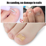 10 PCS Glue-free Orthopedic Nail Stick Toe Nail Groove Inlay Corrector, Transparent Bottom, White Bottom, Blue Bottom