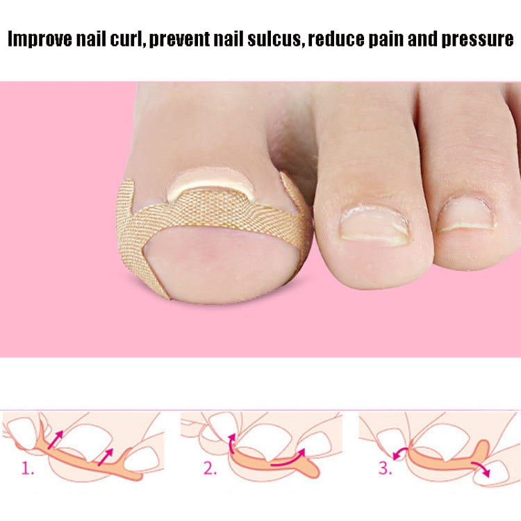 10 Sets Rolled Nail Correction Tape Toe Nail Groove Tape