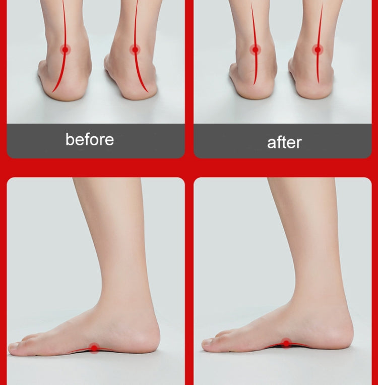 Flat Foot Orthopedic Insole Arch Collapse Support Pad Adult And Child Foot Valgus Orthosis, M (Black), M  (White), L (Black), L (White)