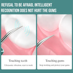 FY-B700 Visual Ultrasonic Scaler Tartar Calculus Tooth Stain Remover Dental Beauty Instrument, Blue Gradient, Red Blue Gradient