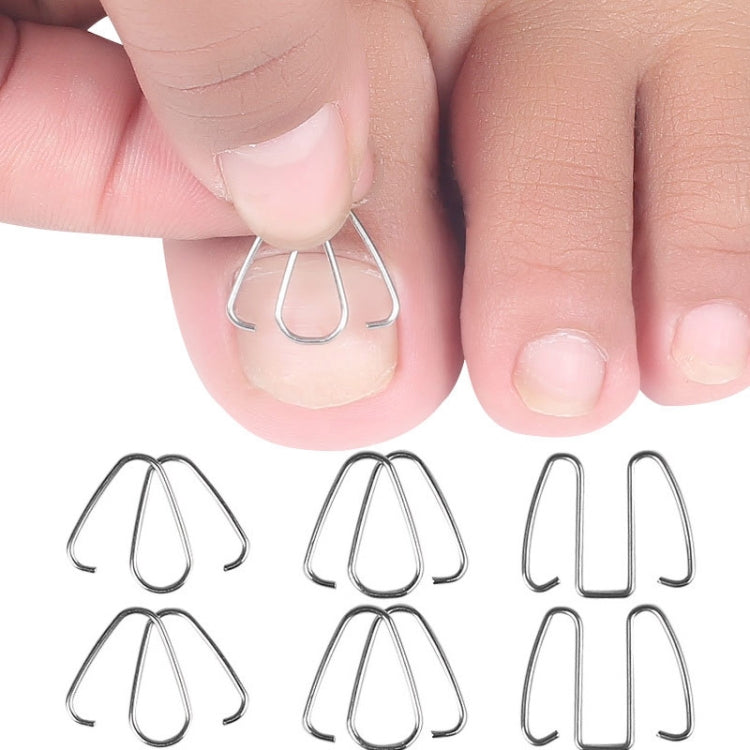 6pcs /Box Ortho Wire Nail Insertion Orthotic Toe Nail Ortho Hooks