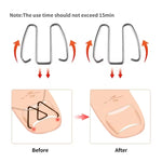 6pcs /Box Ortho Wire Nail Insertion Orthotic Toe Nail Ortho Hooks